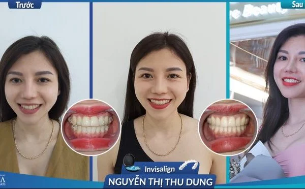 Nguyen-Thi-Thu-Dung-Invi-3-800x371