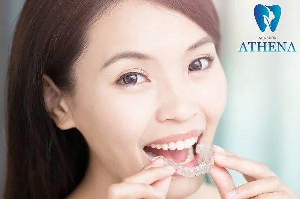 nieng rang khong mac cai