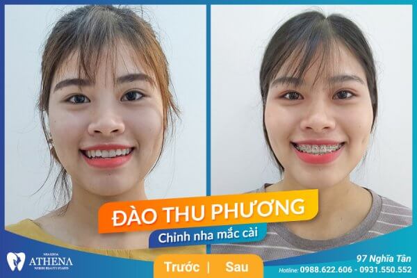 Chinh-nha-mac-cai-kim-loai_Dang-Thu-Phuong-600x400