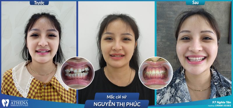 Nguyen-Thi-Phuc-MCS-2-800x371