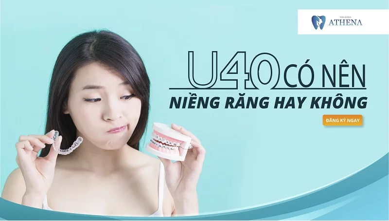 u40 có nên niềng răng hay không