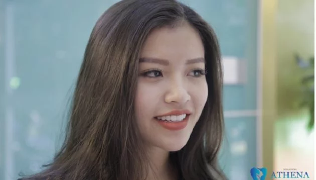 Tấy trắng răng tại Đại Mỗ không đau bằng đèn Plasma 1 Tấy trắng răng tại Đại Mỗ không đau bằng đèn Plasma 1