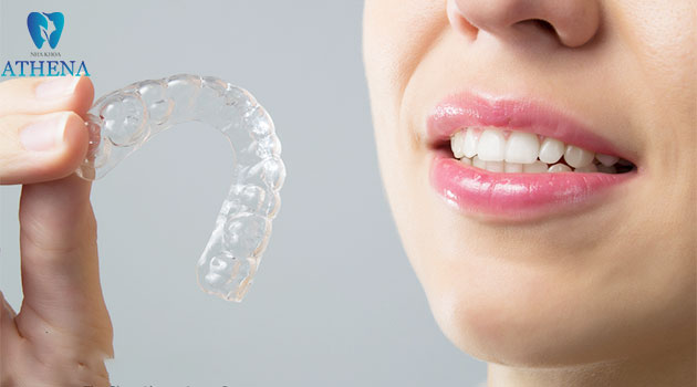 chỉnh nha trong suốt Invisalign