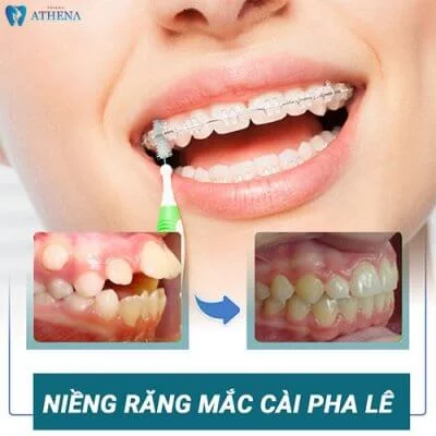 nieng_rang_mac_cai_pha_le nieng_rang_mac_cài_pha_lê