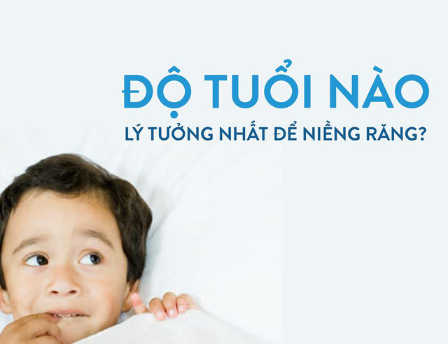 Độ tuổi hợp lý để niềng răng