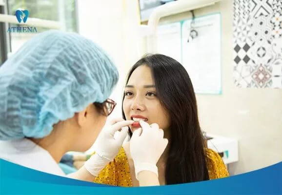 Niềng răng trong suốt Niềng răng trong suốt