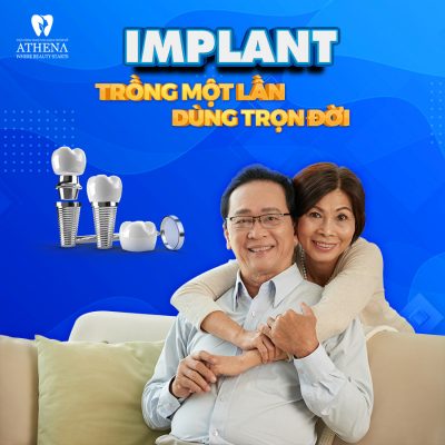 trong-rang-implant