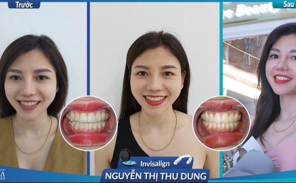 Nguyen-Thi-Thu-Dung-Invi-3-800x371