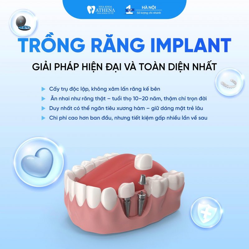 5 NHƯỢC ĐIỂM CỦA TRỒNG RĂNG IMPLANT