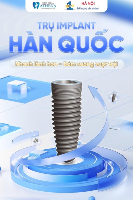 IMPLANT GIÁ RẺ LÀ GÌ? GIẢI PHÁP TIẾT KIỆM CHI PHÍ MÀ VẪN AN TOÀN KHI TRỒNG RĂNG