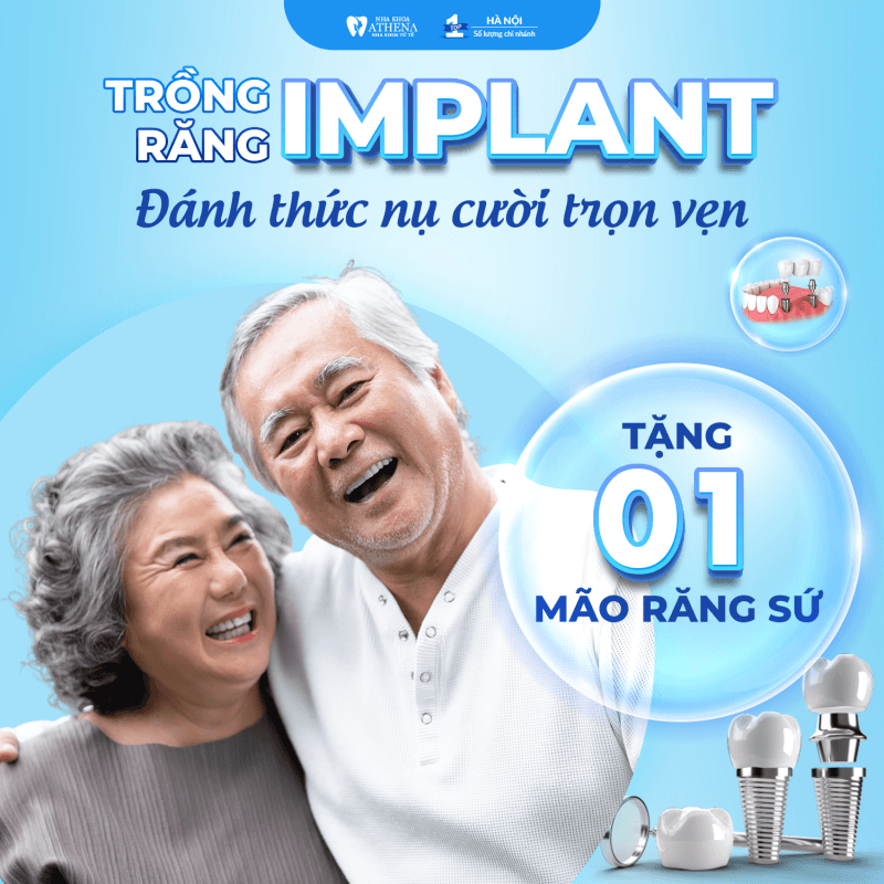 Sự Thật Về Tuổi Thọ Trồng Răng Implant: Có Thể Dùng TRỌN ĐỜI Nếu Bạn Biết 5 Điều Này!