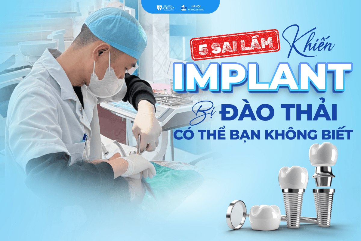 Trụ Implant bị đào thải: 5 sai lầm phổ biến và cách phòng tránh