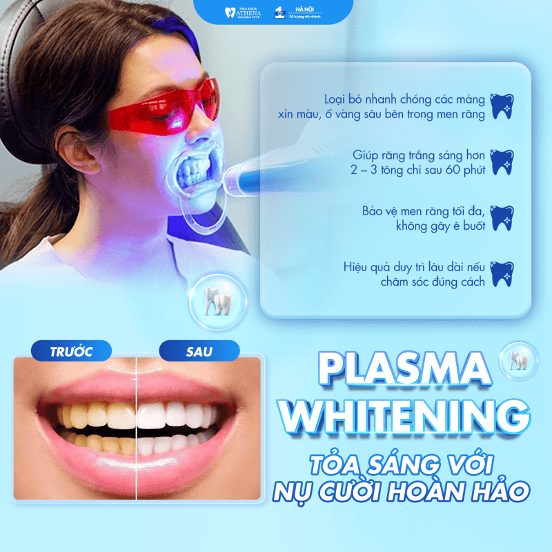 Tẩy trắng răng đón Tết có kịp không? Quy trình, chi phí và ưu đãi mới nhất