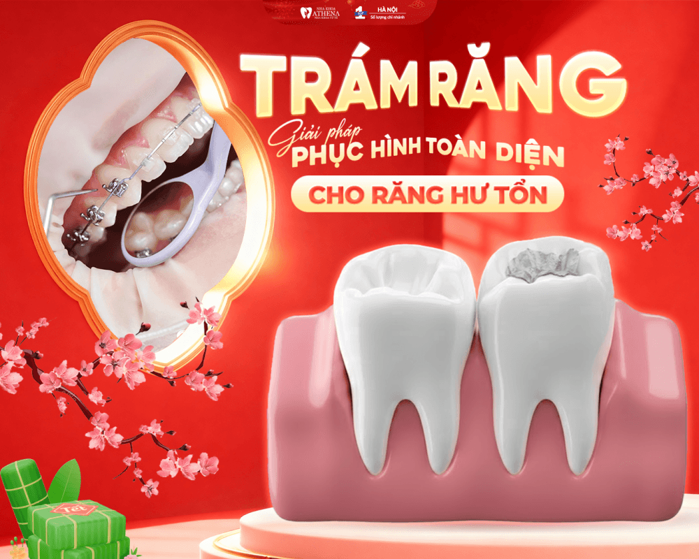 TRÁM RĂNG THẨM MỸ: GIẢI PHÁP PHỤC HÌNH TOÀN DIỆN CHO RĂNG HƯ TỔN
